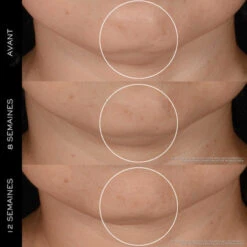 Lancome Rénergie H.P.N. 300-Peptide Crème Anti-Âge Haute-Performance 11 Lancome Rénergie H.P.N. 300-Peptide Crème Anti-Âge Haute-Performance -Guerlain Soldes Boutique renergie hpn 300 peptide 3